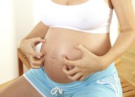 Почему кожа чешется во время беременности?
